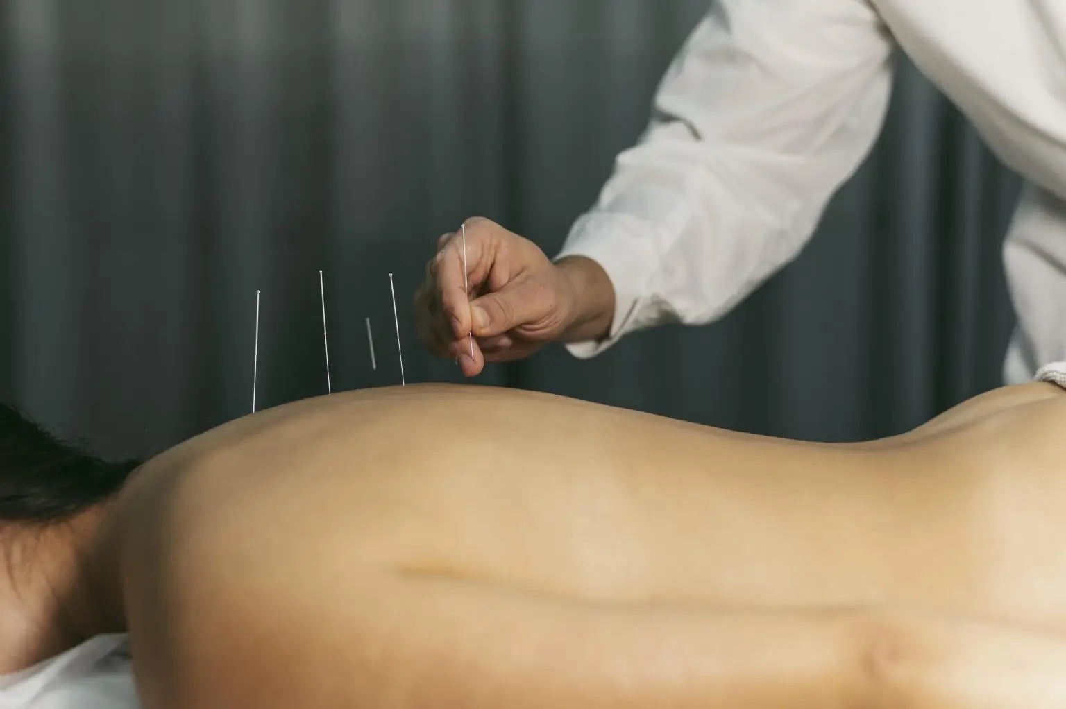 Acupuncturist in Bergen op Zoom
